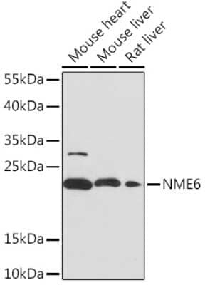 Western Blot: NME6 Antibody [NBP2-93423] - Western blot analysis of extracts of various cell lines, using NME6 Rabbit pAb (NBP2-93423) at 1:1000 dilution. Secondary antibody: HRP Goat Anti-Rabbit IgG (H+L) at 1:10000 dilution. Lysates/proteins: 25ug per lane. Blocking buffer: 3% nonfat dry milk in TBST. Detection: ECL Basic Kit. Exposure time: 120s.